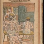 image showing three men in a bathhouse with one administering humoral medicine through cupping to another man.
