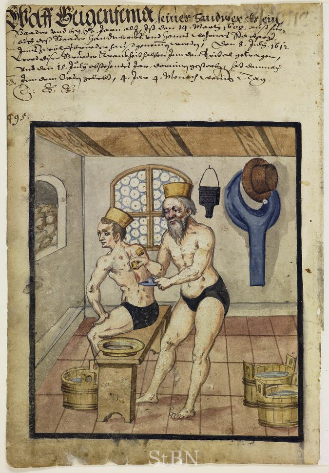 A page from an illustrated manuscript with German text and an 3-quarter page illustration of two men, a doctor and patient. The patient has a cup suctioned to his back and the doctor cuts into his back with a fleam.