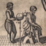 An etching of a doctor and a patient illustrating cupping and bloodletting.