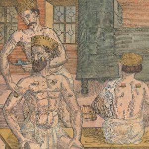 image showing three men in a bathhouse with one administering humoral medicine through cupping to another man.